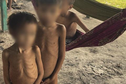 Malnourished Yanomamai Children